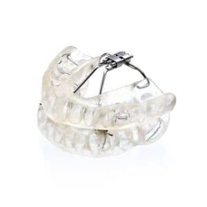 clear oral appliance with metal expander